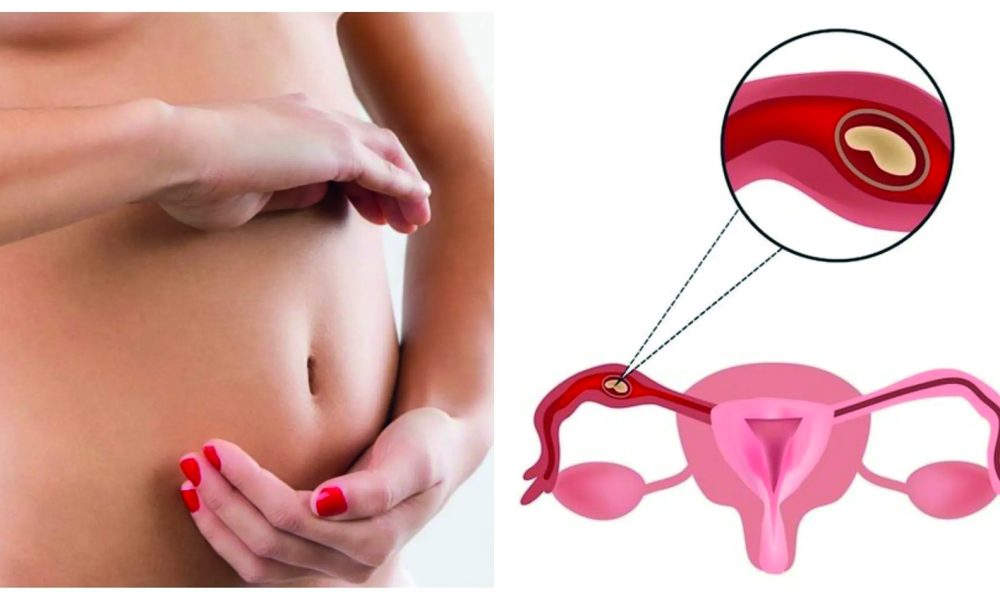 Nutrigenética y Fertilidad