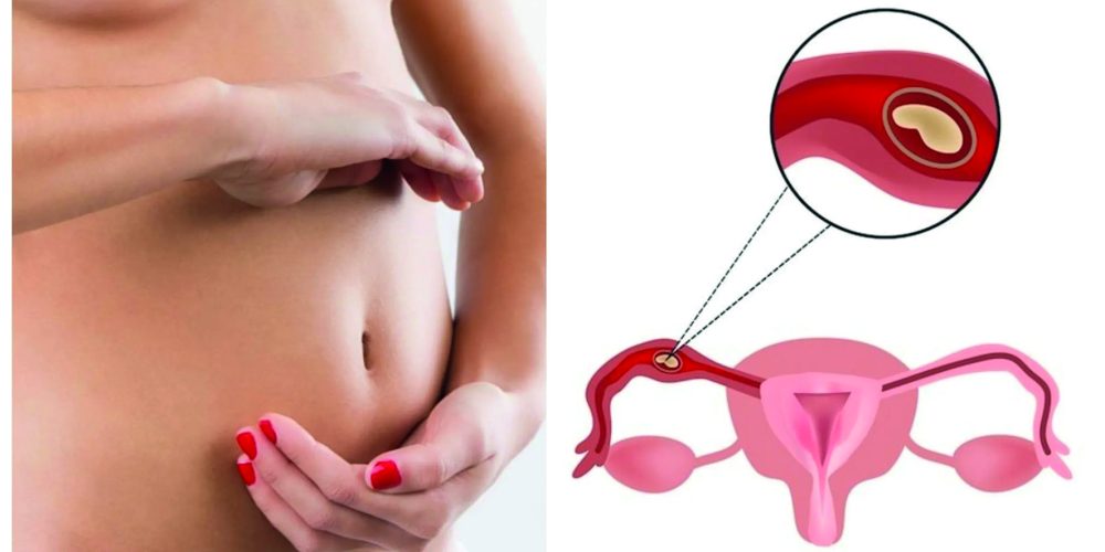 Nutrigenética y Fertilidad